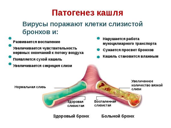 патогенез кашлю