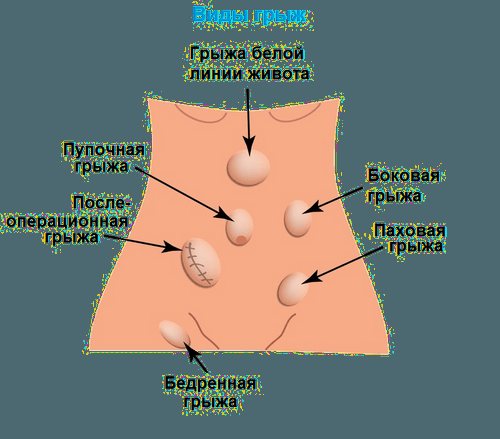 Пазновідності гриж