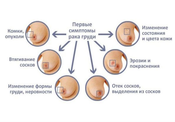 перші симптоми раку