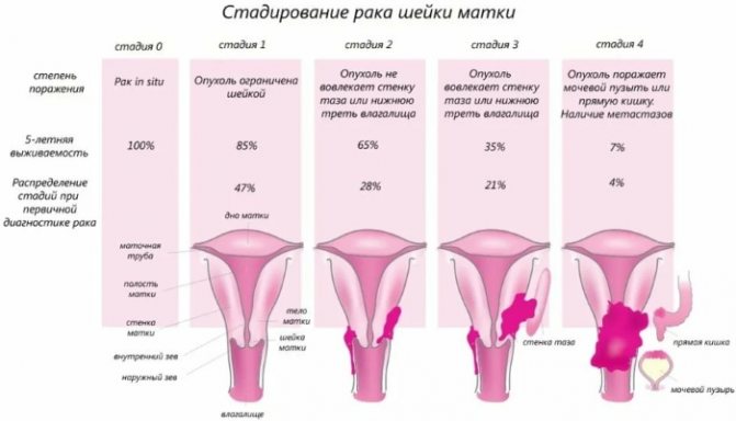 Базальноклеточная карцинома фото и описание