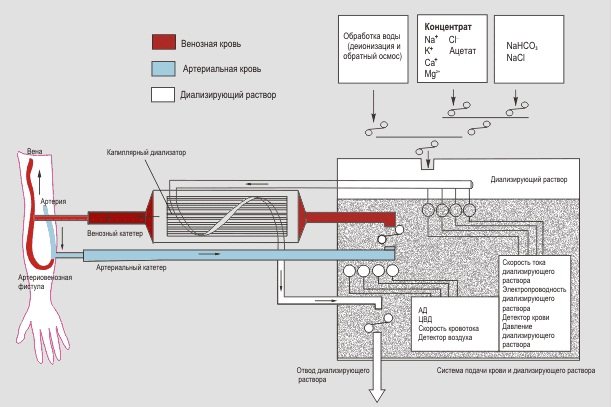 Алгоритм і методи сучасного лікування гострої ниркової недостатності