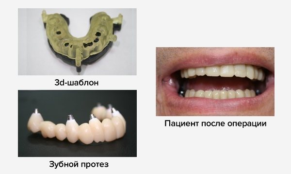 переваги методики