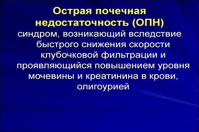 Пререналная гостра ниркова недостатність