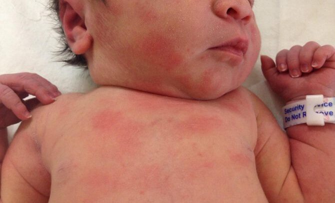 Коло для купання новонароджених – зі скількох місяців застосовувати?