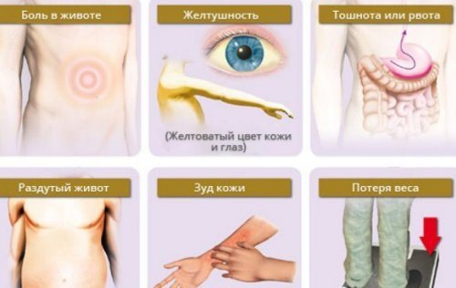 Ознаки захворювання печінки
