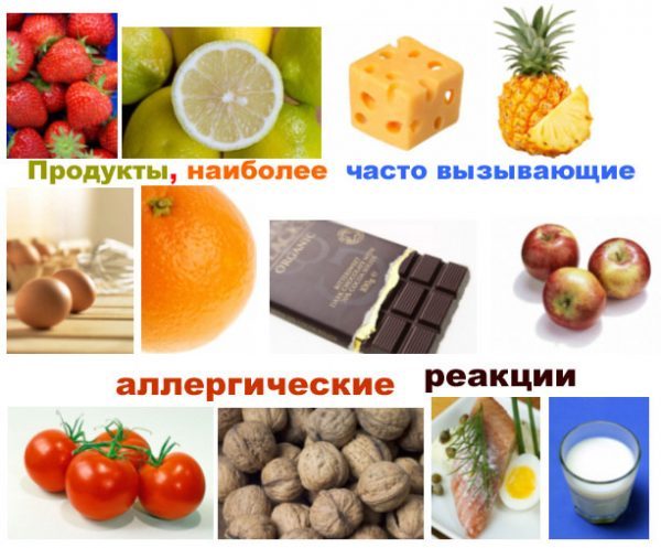 Продукти-алергени, заборонені при кропивниці