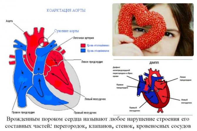 Все, що потрібно знати батькам про синдром Шерешевського-Тернера у дитини