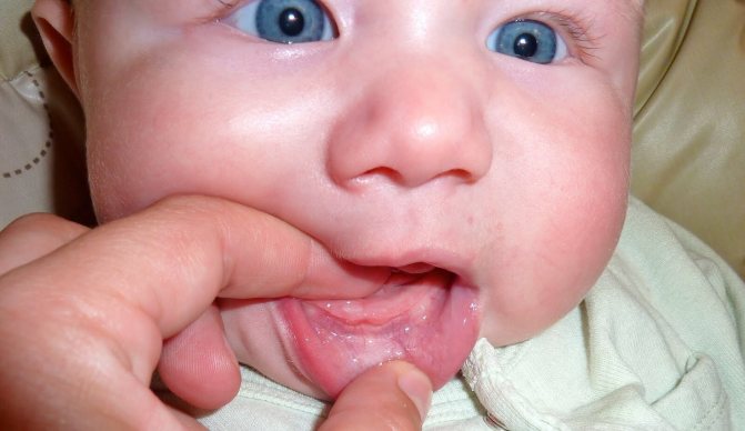 Как вылазиют зубки у малышей фото