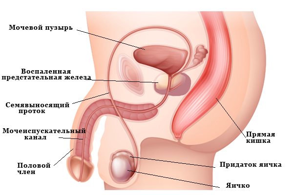 Перші ознаки простатиту у чоловіків: симптоми і відчуття