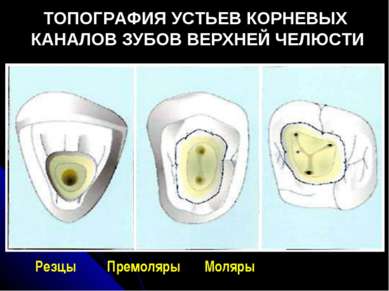 Розташування каналів коренів зубів на верхній щелепі