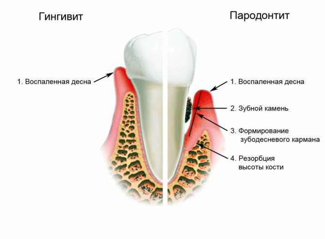 різниця