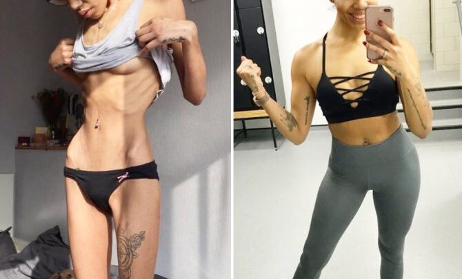 Анорексія: що це з позиції психології. Як впливає анорексія на психіку: до і після