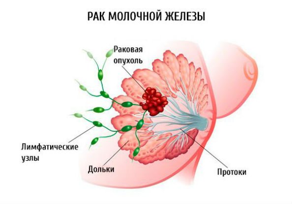 схема грудей