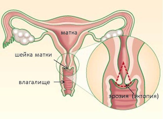 схема матка