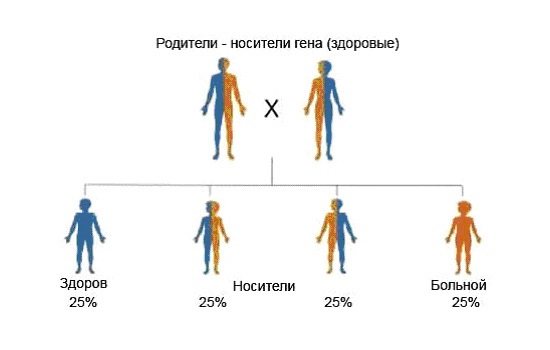 схема успадкування муковісцидозу