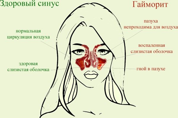 Сіалор (Sialor) для дітей.  Відгуки, інструкція, краплі, аналоги, ціна