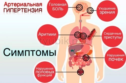 Симптоми артеріальної гіпертензії