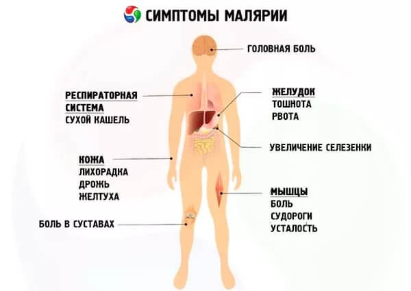 симптоми малярії