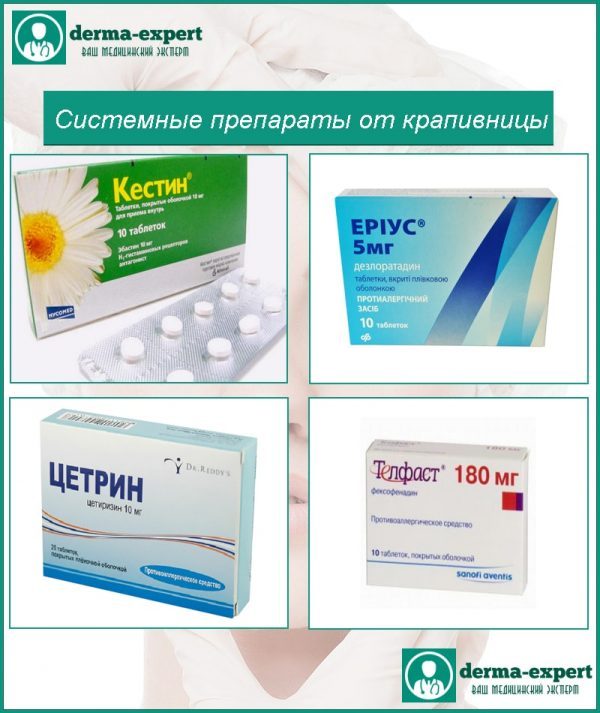 Системні препарати від кропив'янки