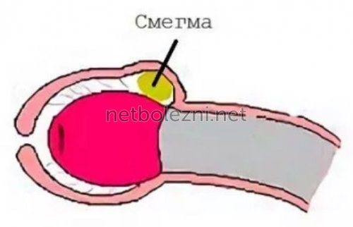 Особливості будови і функції вуздечки статевого члена