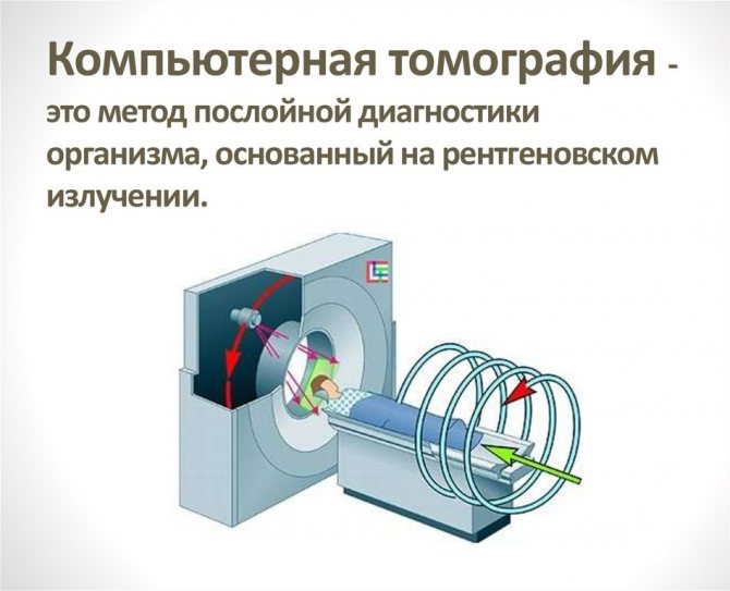 МРТ з металевими коронками чому не можна робити