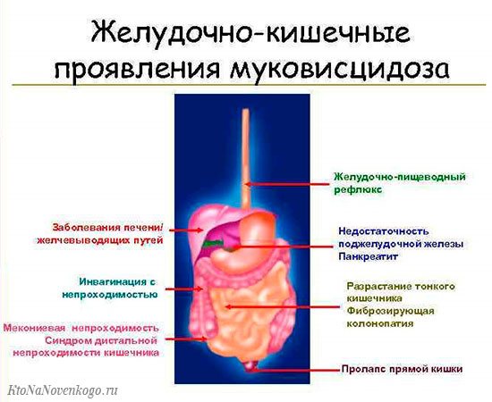 стадії