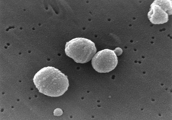 Streptococcus pneumoniae: скануюча електронна мікроскопія.