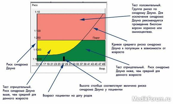 Потрійний тест на синдром Дауна