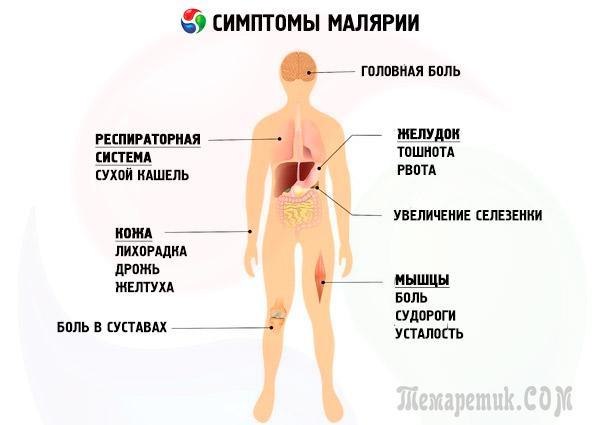 Тропічна малярія симптоми