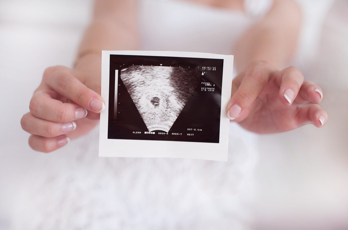 Ультразвукове сканування вагітних 1 триместр
