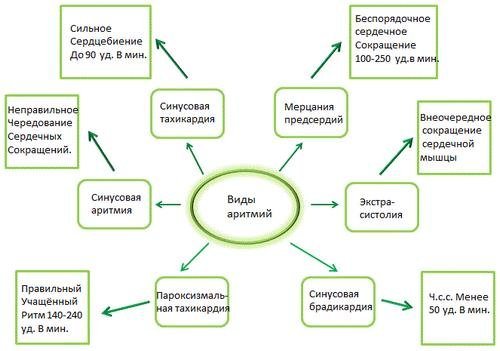 Види серцевої аритмії