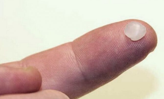 Як користуватися захисним ортодонтичним воском для брекетів, щоб знизити неприємні наслідки їх носіння