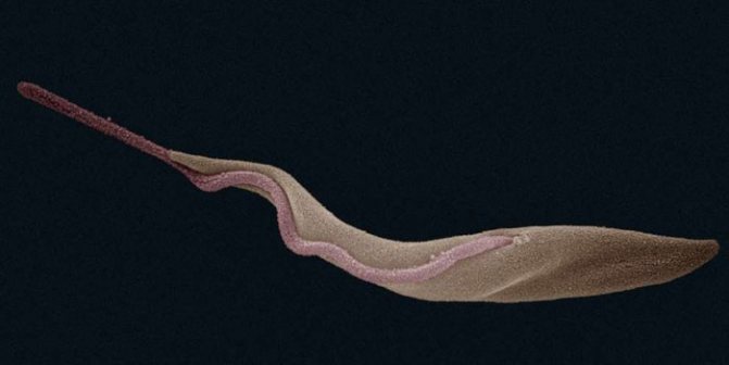 Збудник хвороби Trypanosoma brucei rhodesiense