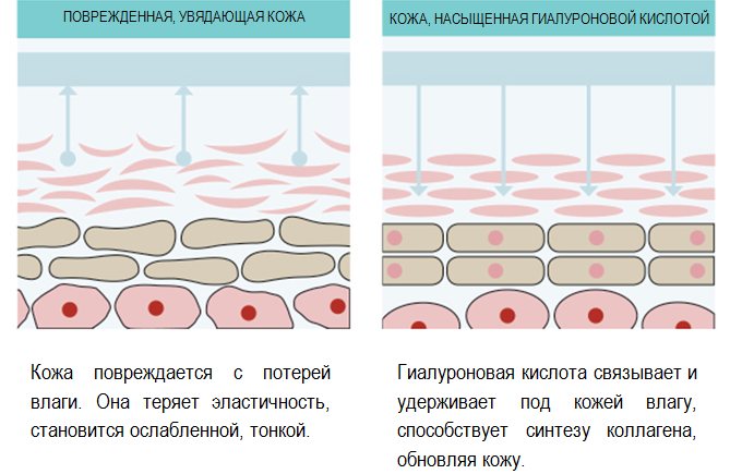 Вплив гіалуронової кислоти на шкіру обличчя