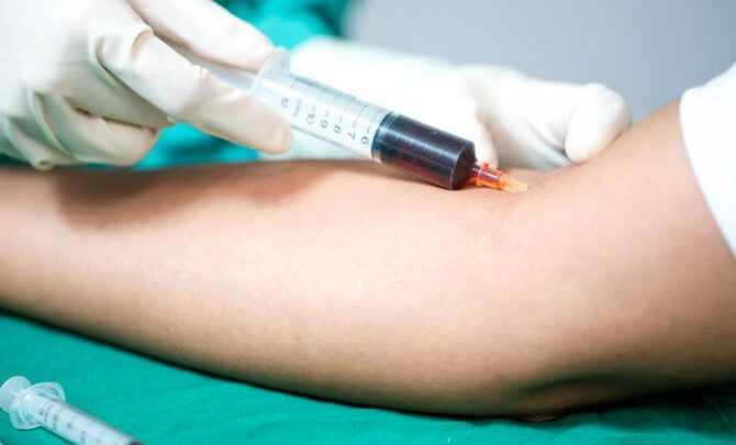 За що відповідають лейкоцити в організмі людини? Для чого вони потрібні, їх функції