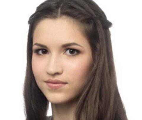 Вуха розвісили: Хадсон, Кідман і інші зірки з незвичайними вухами