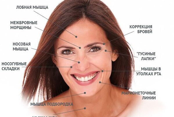 Де застосовується ботулінотерапія: зони застосування, препарати